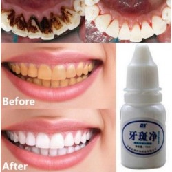Teeth whitening water 10 mlMouth
